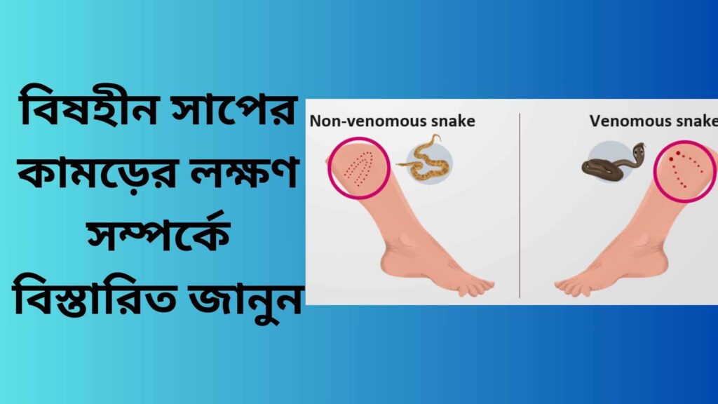 বিষহীন সাপের কামড়ের লক্ষণ সম্পর্কে বিস্তারিত জানুন