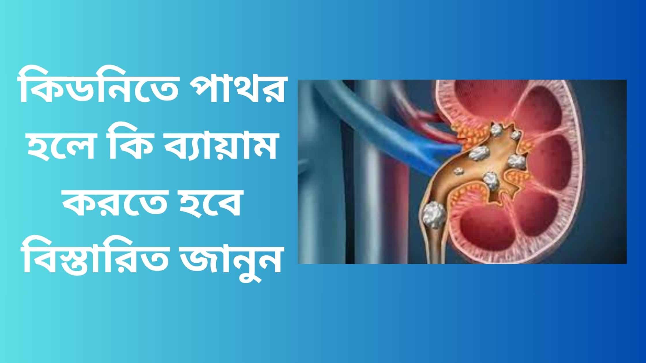 কিডনিতে পাথর হলে কি ব্যায়াম করতে হবে বিস্তারিত জানুন